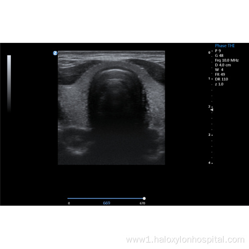 hospital mobile color ultrasound machine laptop cardiac
